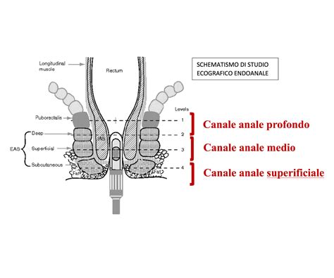 Illustrazione anatomica del canale anale con evidenziate emorroidi e ragadi