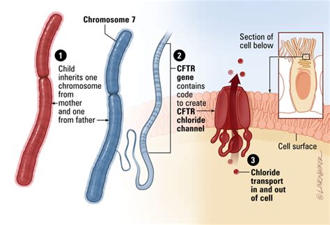 rappresentazione del gene CFTR e della proteina CFTR difettosa