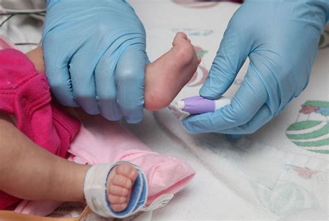 neonati sottoposti a screening neonatale con prelievo dal tallone