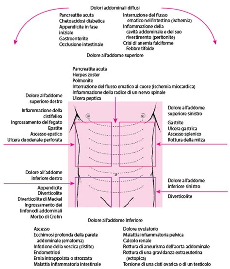 Diagramma che mostra le aree di dolore addominale associate alla sindrome HELLP