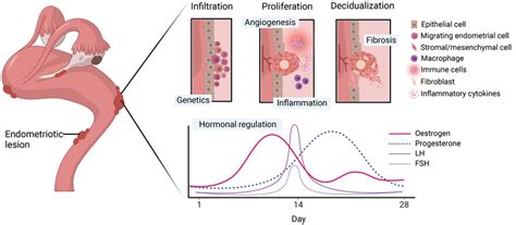 endometriosis lesions diagram