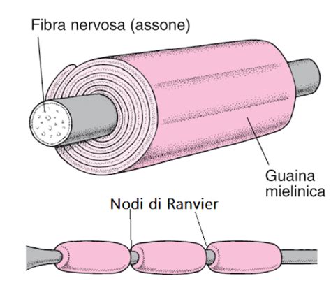 rappresentazione schematica dell'accumulo di solfatidi nella guaina mielinica
