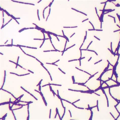 Microscope image of Bacillus cereus bacteria with a focus on its rod shape