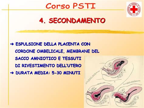 Il secondamento: espulsione della placenta
