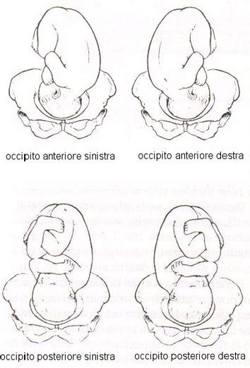 Differenze tra Posizione Occipito-Anteriore e Occipito-Posteriore