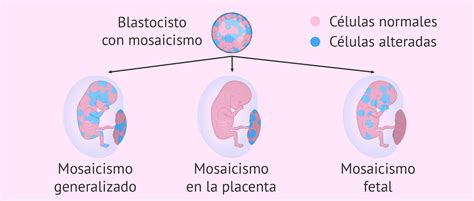 illustrazione del fenomeno del mosaicismo confinato alla placenta