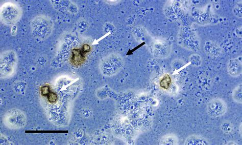 Microscopio e Ureaplasma urealyticum
