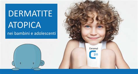 Dermatite atopica nei bambini