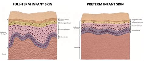 Baby skin barrier development