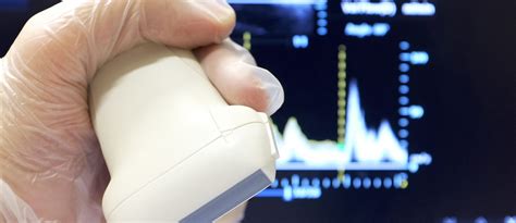 Ecocolordoppler vascolare in fase di analisi