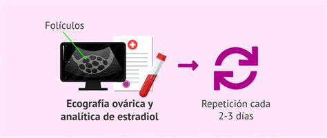 schema del monitoraggio ecografico durante la stimolazione ovarica