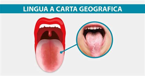 Lingua a carta geografica