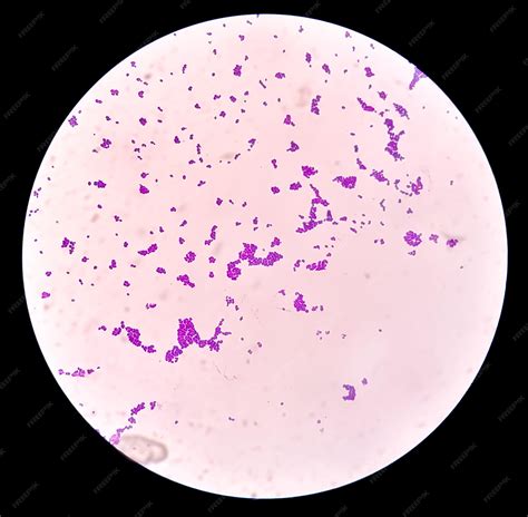 Candida albicans microscopica