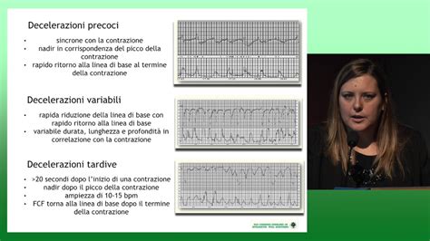 Tracciato Cardiotocografico Esempio