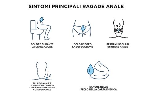 Schema di una ragade anale con enfasi sulla lacerazione della mucosa