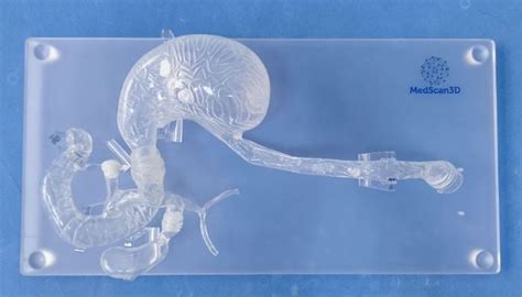 Stampa 3D di un modello anatomico cardiaco per pianificazione chirurgica