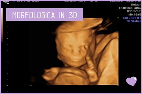 Ecografia di secondo livello