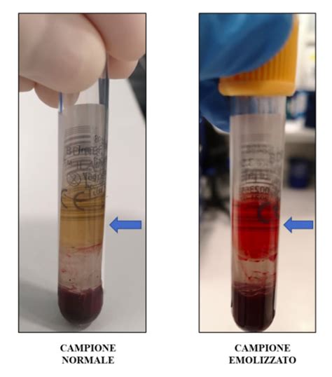 schema del processo di prelievo e analisi del campione in laboratorio