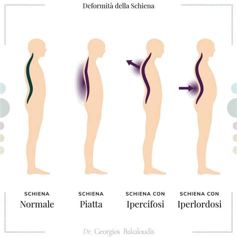 Esempi di ovociti con dismorfismi citoplasmatici ed extracitoplasmatici