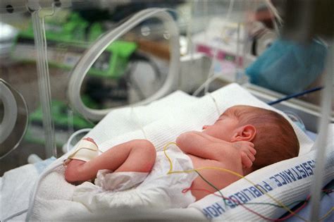 Diagramma delle complicanze del neonato pretermine