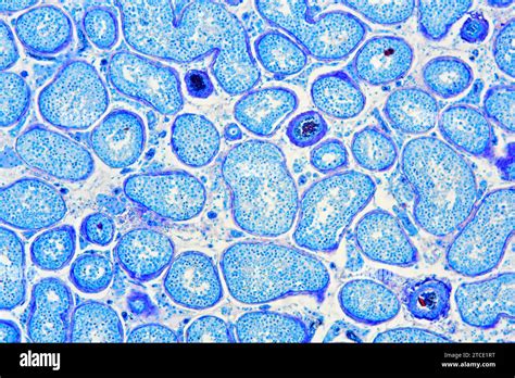 Microscopio che mostra cellule di villi coriali