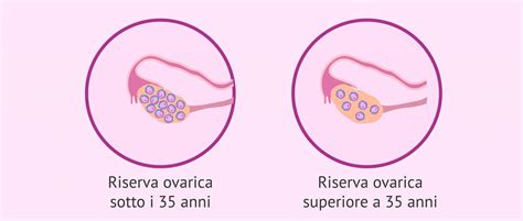 grafico che illustra il declino della riserva ovarica nel corso della vita femminile