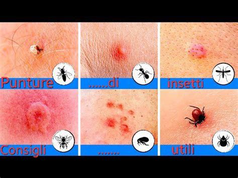 infografica che illustra le differenze tra trattamenti chimici e trattamenti a calore per le punture