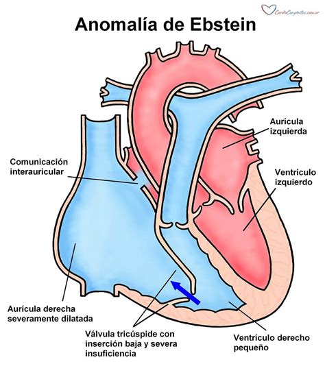 Illustrazione di anomalie cardiache fetali