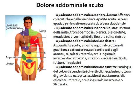 Mappa del Dolore Addominale: Possibili Cause