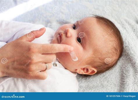 bambino con eczema applicazione crema