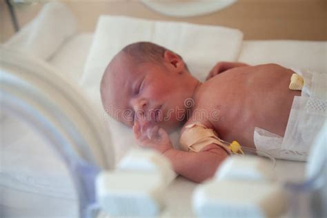 Immagine di un neonato prematuro in incubatrice