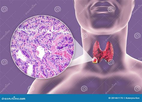 illustrazione scientifica che mostra il legame dell'ormone Beta-HCG