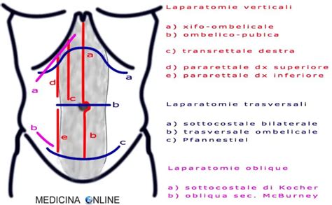 rappresentazione schematica dell'utero in gravidanza e incisione chirurgica