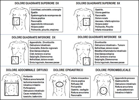 Diagramma delle zone di dolore pelvico e addominale in gravidanza
