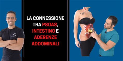 illustrazione schematica delle aderenze addominali post-operatorie che collegano diversi organi