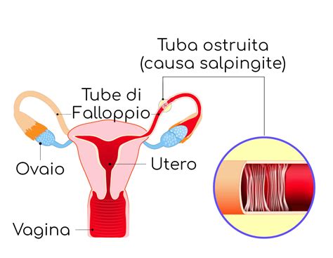 Schema delle tube di Falloppio