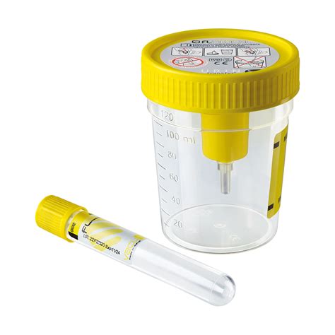 Laboratorio analisi con provette di urine