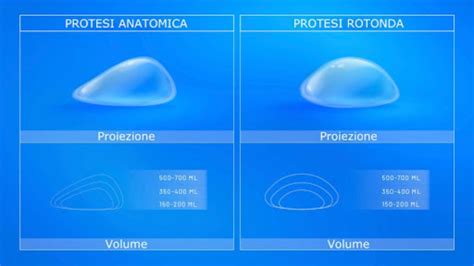 Diagramma delle posizioni delle protesi mammarie (sottomuscolare, sottoghiandolare, dual plane)