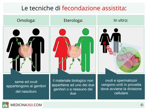 Schemi delle tecniche di fecondazione assistita