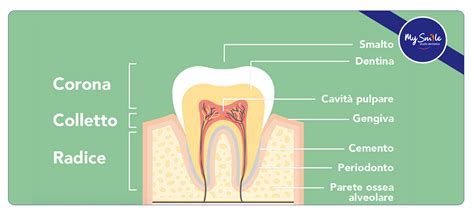 Struttura di un dente con indicazione dei tipi di ascesso (endodontico, parodontale, gengivale)
