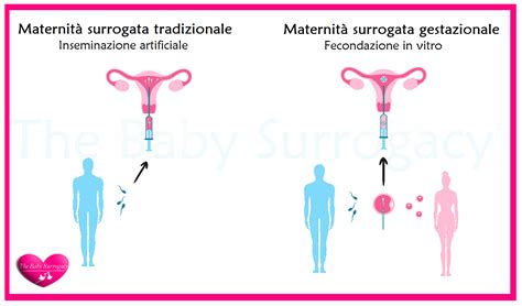 Tavola comparativa delle tipologie di maternità surrogata