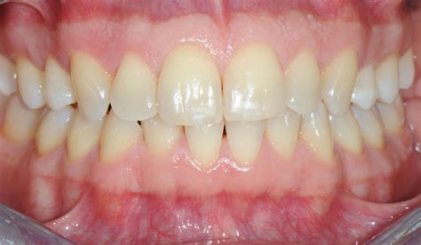 illustrazione di una bocca sana con gengive rosa e denti bianchi
