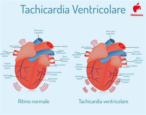 Differenza tra frequenza cardiaca normale e tachicardia