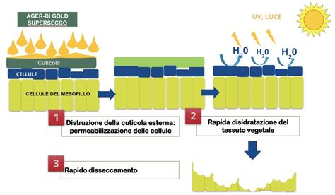 Illustrazione delle diverse tecniche di litotrissia