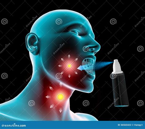 illustrazione di una gola irritata con virus e batteri