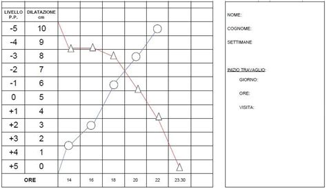 Grafico semplificato del partogramma con enfasi sui 5 cm di dilatazione