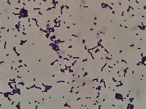Illustrazione del batterio Streptococcus agalactiae (GBS) con indicazione delle vie di colonizzazione