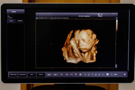 Ecografia 3D feto 34 settimane