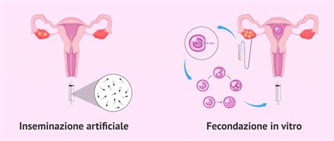 Illustrazione del meccanismo d'azione del Gonasi nella stimolazione dell'ovulazione