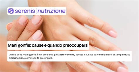 Mani gonfie in gravidanza con anello